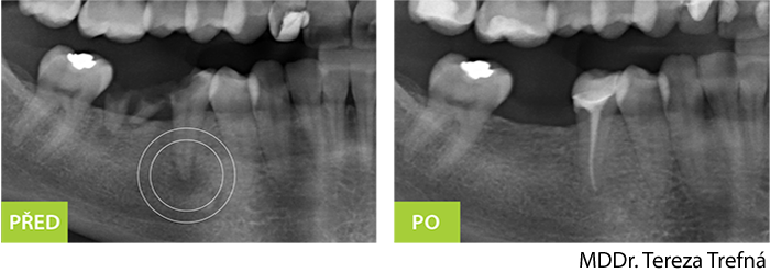 Endodontické vyšetřenív2