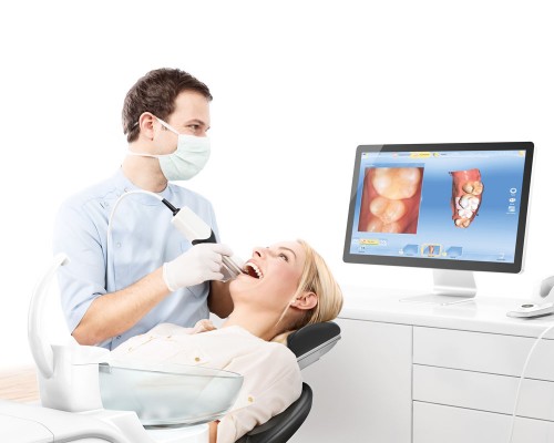 cerec3